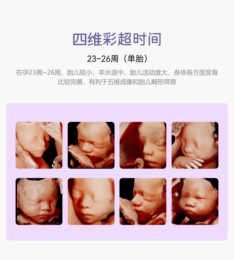 北京安琪妇产医院四维彩超检查时间